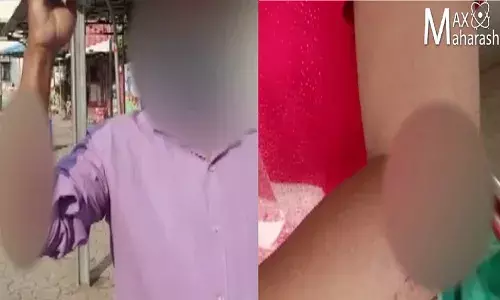 पिसाळलेल्या कुत्र्याचा एकाच दिवसात अनेकांना चावा