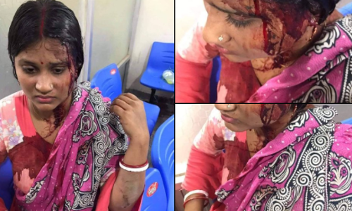 पश्चिम बंगाल हिंसाचार: मारहाण झालेल्या महिलेचा फोटो नक्की कधीचा?