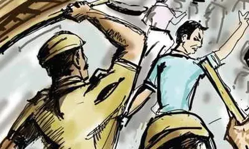 पोलीसांनी भाजप पदाधिकाऱ्याला लाठ्या तुटेपर्यंत केली मारहाण पोलीसांनी भाजप पदाधिकाऱ्याला लाठ्या तुटेपर्यंत केली मारहाण