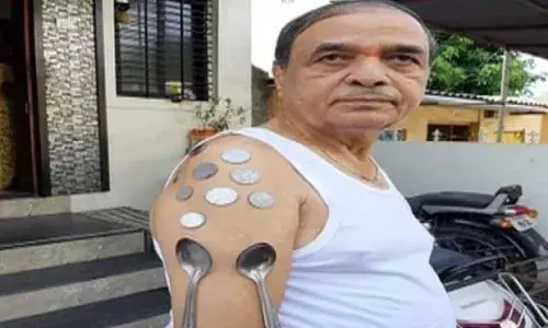वस्तू अंगाला का चिटकते? वस्तू अंगाला का चिटकते?