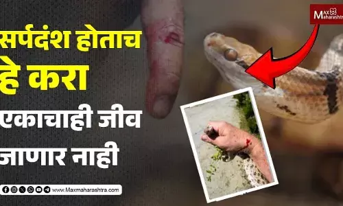 सर्पदंश होताच हे करा एकाचाही जीव जाणार नाही सर्पदंश होताच हे करा एकाचाही जीव जाणार नाही