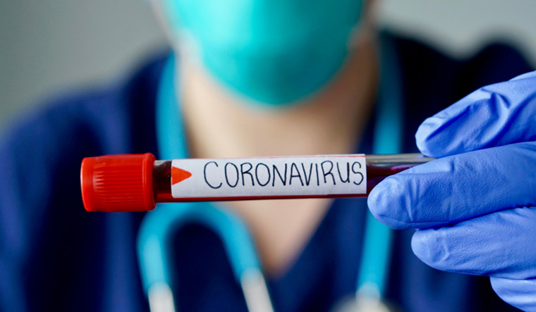 HIV व्हायरस संपला नाही, तसा कोरोना व्हायरस कधीच न संपण्याची शक्यता... HIV व्हायरस संपला नाही, तसा कोरोना व्हायरस कधीच न संपण्याची शक्यता...